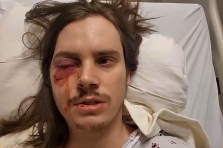 ‘No Kings’ rioter may lose his right eye after being hit by a rubber bullet.